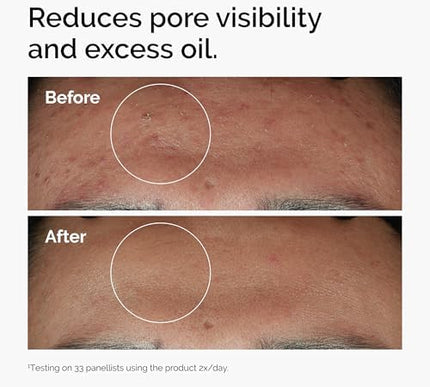 Product Image 2 - The Ordinary Niacinami