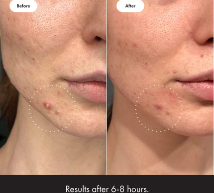 Product Image 4 - Mighty Patch Invisible