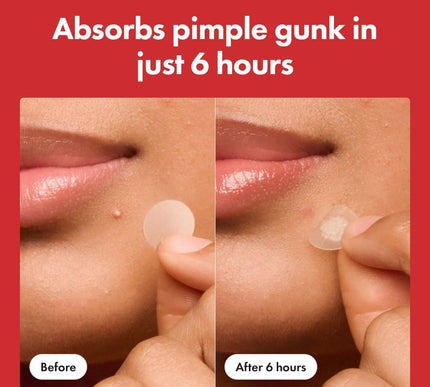 Product Image 5 - Mighty Patch Original 