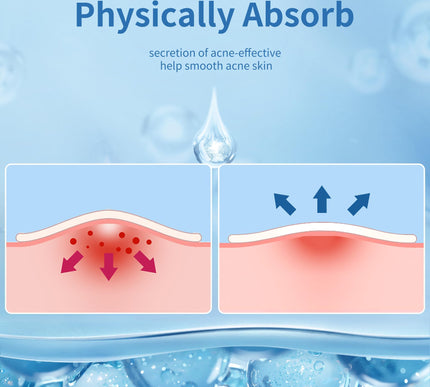 Product Image 7 - Daolyo Large Acne Pimp