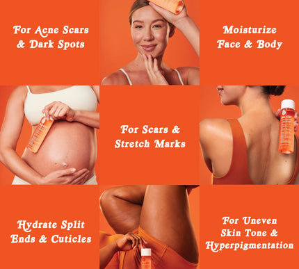 Product Image 5 - BioOil Skincare Body O