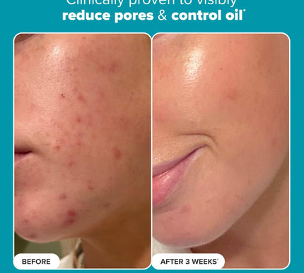 Product Image 4 - Paulas Choice SKIN PER