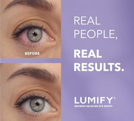 Product Image 2 - LUMIFY Eye Drops for R