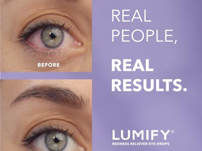 Product Image 2 - LUMIFY Eye Drops for R