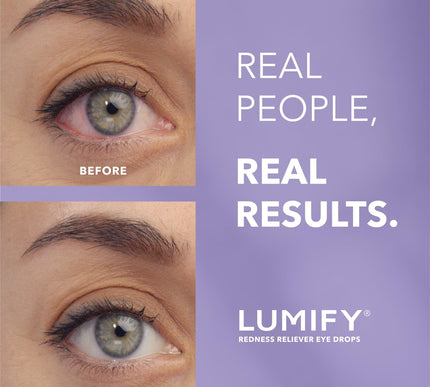 Product Image 2 - LUMIFY Eye Drops for R