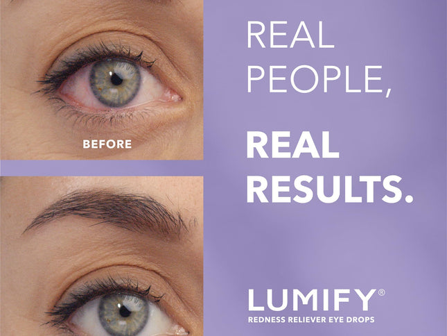 Product Image 2 - LUMIFY Eye Drops for R