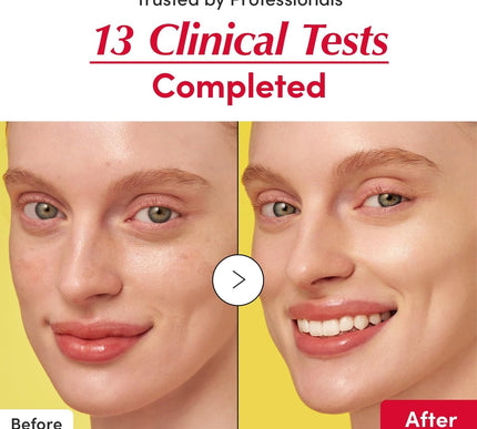 Product Image 6 - EQQUALBERRY Vitamin Il