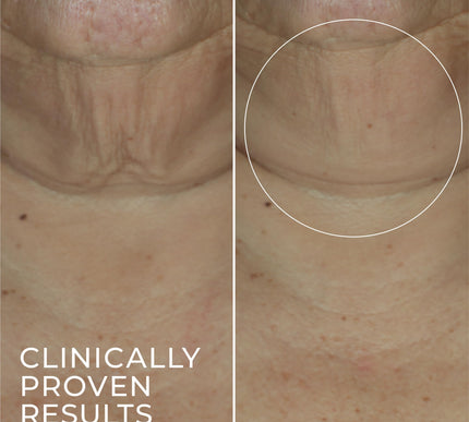 Product Image 6 - RoC Derm Correxion Ret