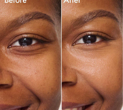 Product Image 3 - Catrice Under Eye Brig