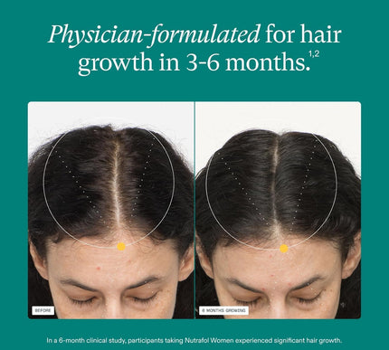 Product Image 4 - Nutrafol Womens Hair G
