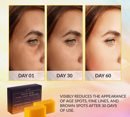 Product Image 2 - Valitic Kojic Acid Dar