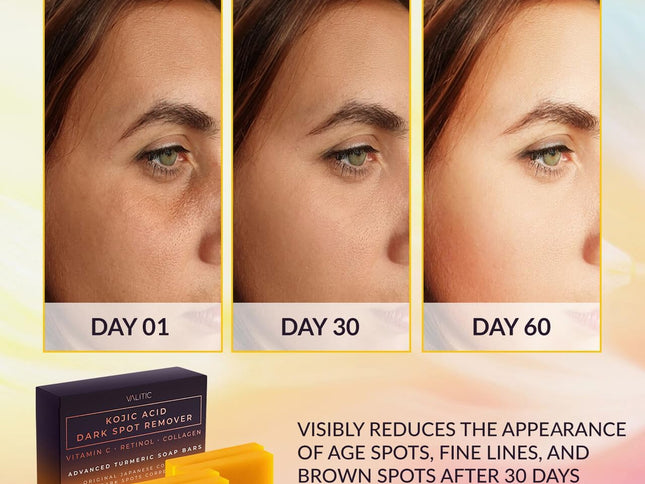 Product Image 2 - Valitic Kojic Acid Dar