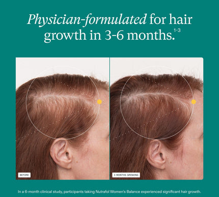 Product Image 4 - Nutrafol Womens Balanc