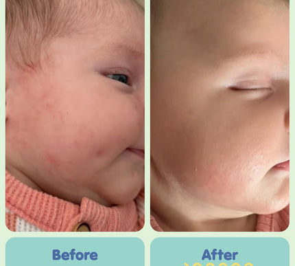 Product Image 5 - TUBBY TODD All Over Oi