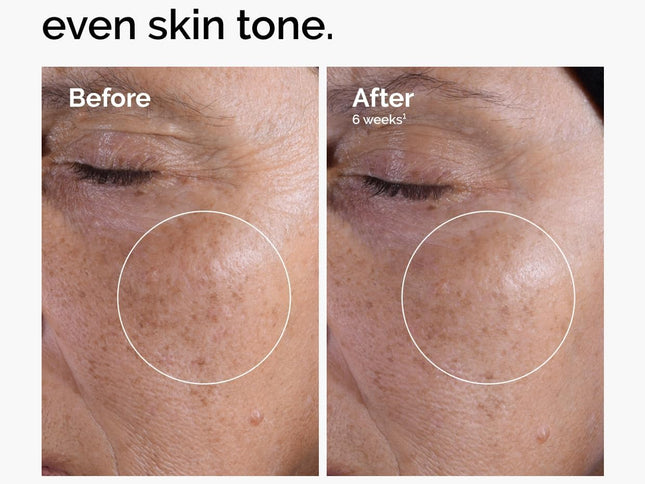 Product Image 2 - The Ordinary Glycolic 