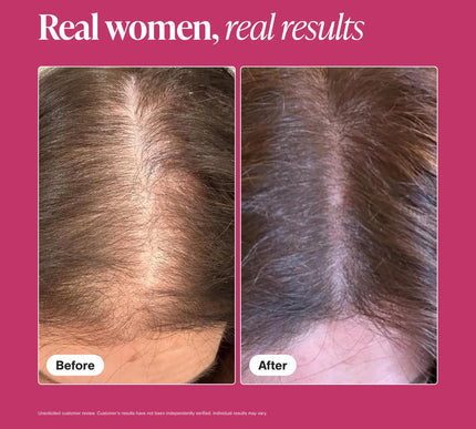 Product Image 5 - Viviscal Hair Growth S