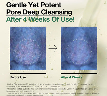 Product Image 6 - Anua Heartleaf Pore Co