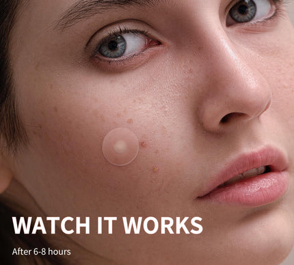 Product Image 6 - Daolyo Large Acne Pimp