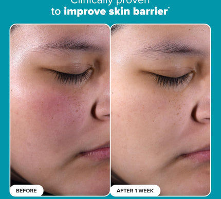 Product Image 3 - Paulas Choice SKIN PER