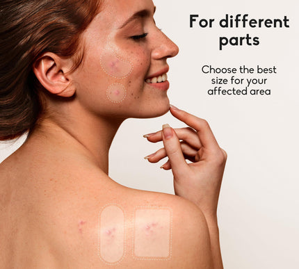 Product Image 3 - Daolyo Large Acne Pimp