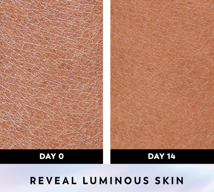 Product Image 5 - Olay Super Serum Body 